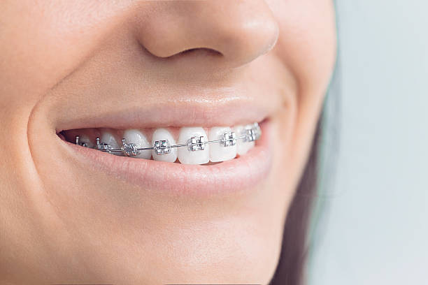 Best Invisalign and Clear Aligners  in Tulia, TX